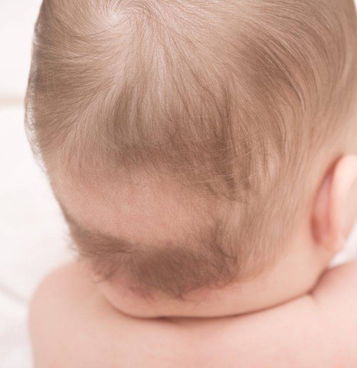 Выпадают волосы у ребенка: причины плохих волос, профилактика