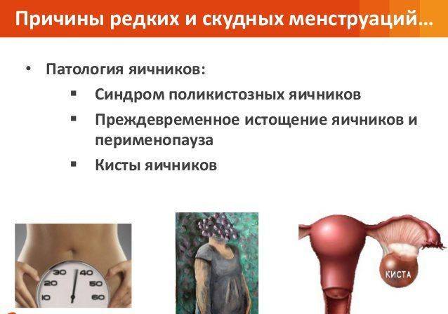 Гипоменорея - лечение гипоменореи в санкт-петербурге | сеть клиник "далимед"