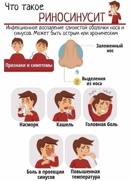 Аденоиды — симптомы, причины и лечение