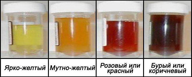 Цистит у женщин: лечение, симптомы и причины. рекомендации врача-гинеколога.