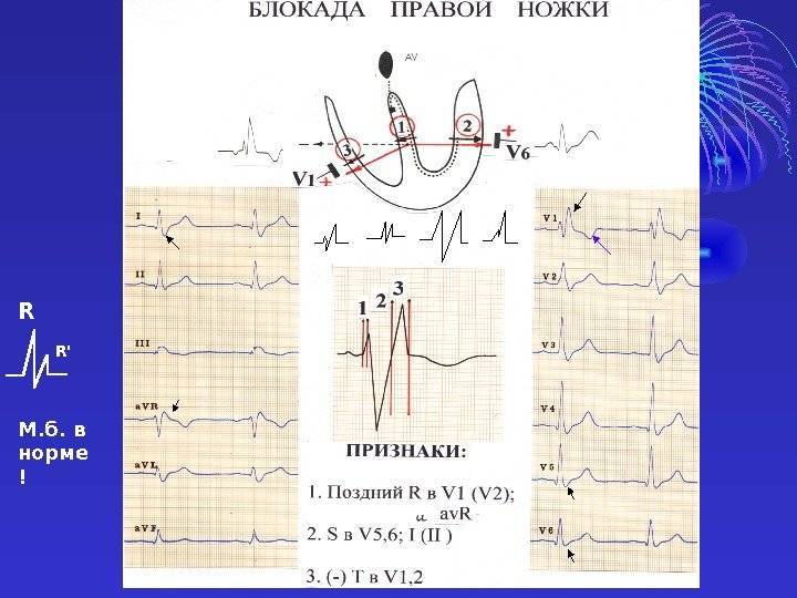 Нарушения проводимости сердца | что делать, если нарушилась проводимость сердца? | лечение нарушений и симптомы болезни на eurolab