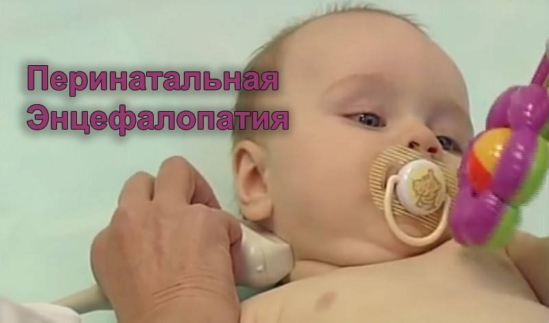 Поражение головного мозга у новорожденных. Перинатальная энцефалопатия у детей. Постгипоксическая энцефалопатия у новорожденных. Перинатальные поражения нервной системы у новорожденных. Энцефалопатия у новорожденных.