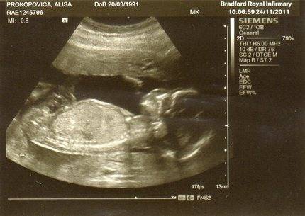 21 неделя беременности: фото, развитие плода, что происходит с организмом женщины. узи