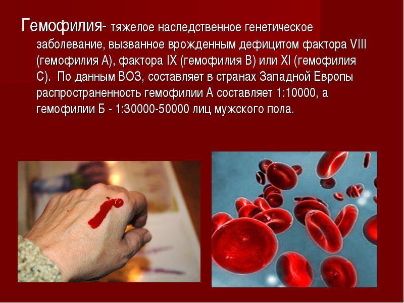 Гемофилия — большая медицинская энциклопедия