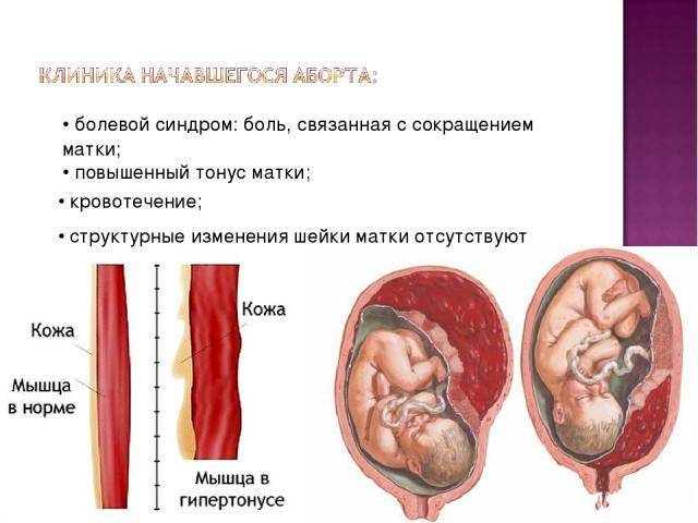 Обезболивающие препараты в период беременности