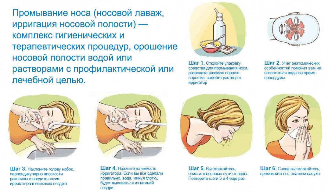 Хлоргексидин в нос: как использовать для промывания при насморке ребенку, способ применения при гайморите, промывка в домашних условиях