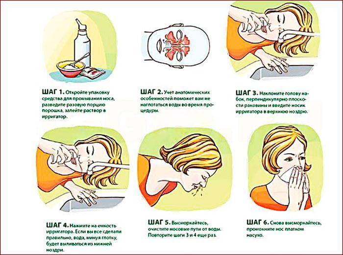 Как правильно промыть нос ребенку | без соски - здоровое развитие ребенка