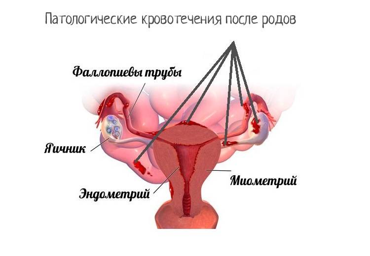 Цикл после родов на искусственном вскармливании