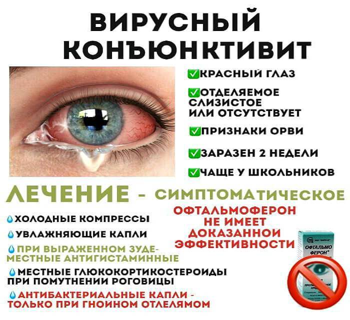 Глазные капли при гнойном конъюнктивите у детей - энциклопедия ochkov.net