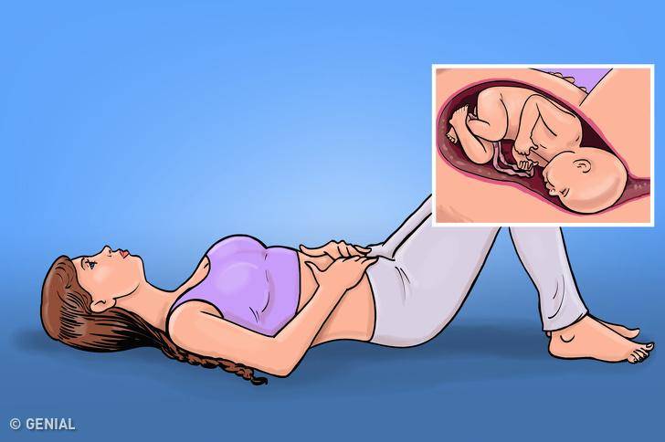 Коленно-локтевое положение при беременности: спасение или очередная пустышка?