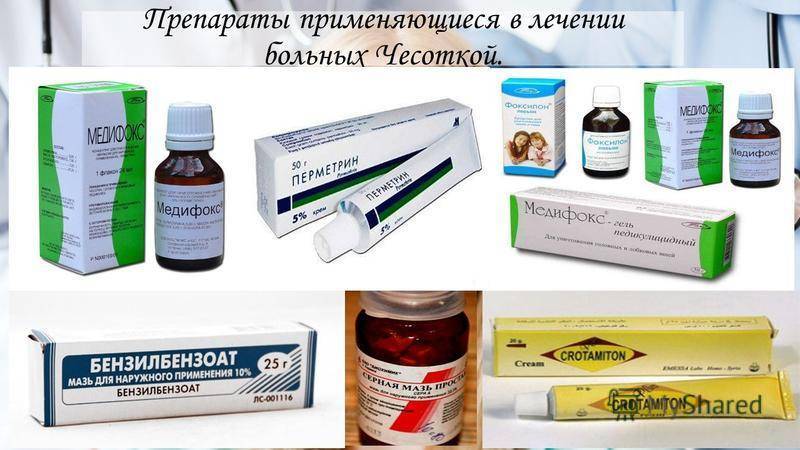 Стригущий лишай у ребенка. как обнаружить, предотвратить и лечить