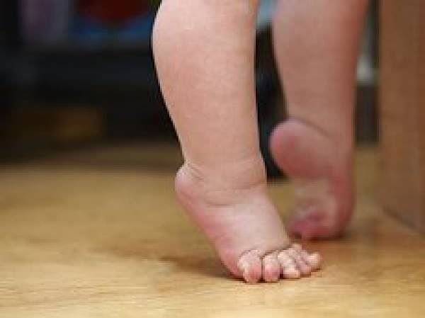 Почему ребенок ходит на носочках (цыпочках): причины, лечение