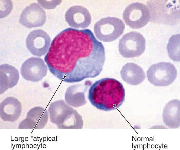 Мононуклеары в анализе крови ребенка