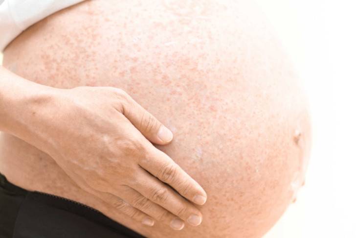 Высыпания у беременной женщины — причины
