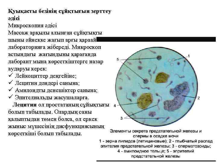 Биохимия спермы (цинк, лимонная кислота, фруктоза)