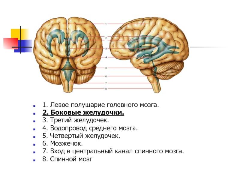 Кровоизлияние в желудочки головного мозга