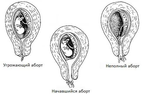 Косметологические процедуры для беременных – «юнимед-с»