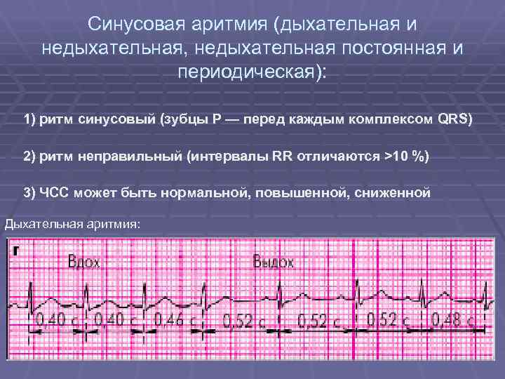 Расшифровка экг: наиболее важные показатели кардиограммы с примерами нарушений