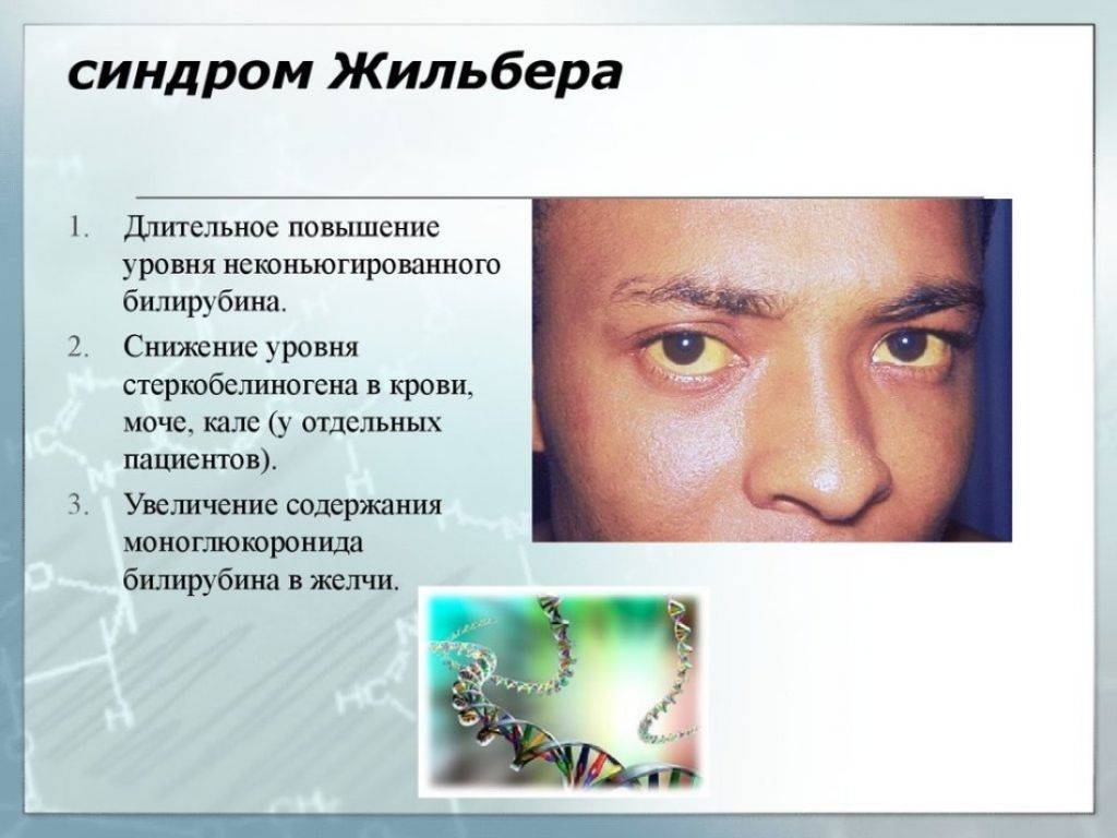 Синдром жильбера: сдать анализ в лаборатории kdlmed