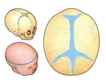 Впалый родничок у грудничка: причины западения темечка с фото