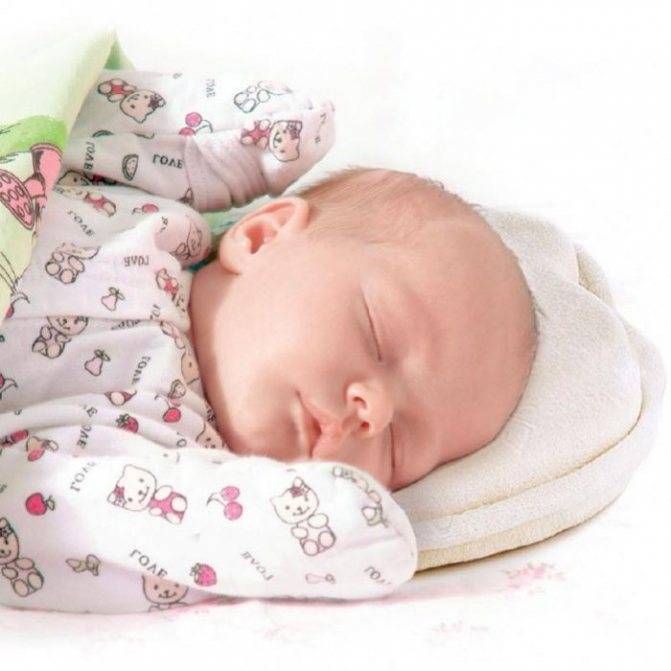 Как использовать ортопедическую подушку для новорожденного для исправления формы головы
