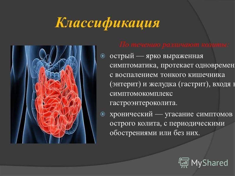 Энтерит | симптомы | диагностика | лечение - docdoc.ru