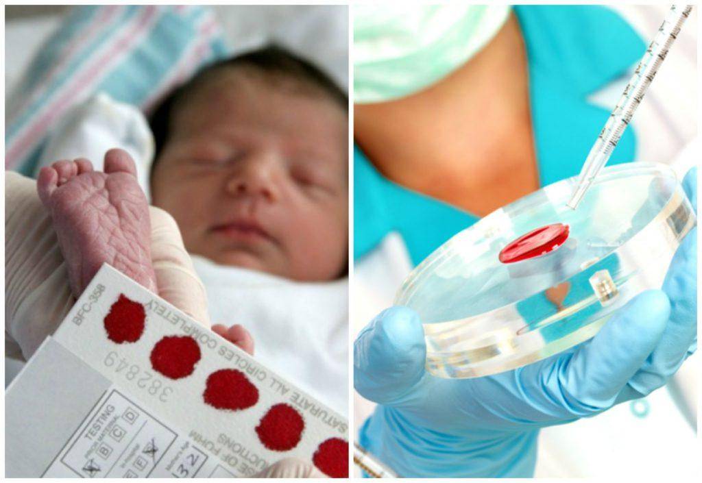 Диагностика и лечение цитомегаловирусной инфекции у беременных и новорожденных