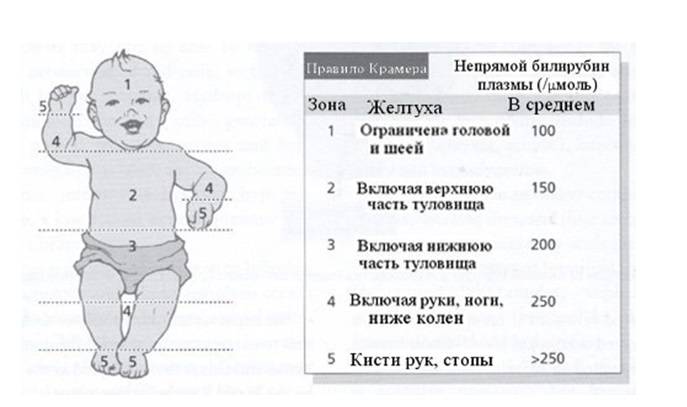 Билирубин: норма у новорожденного. таблица по месяцам