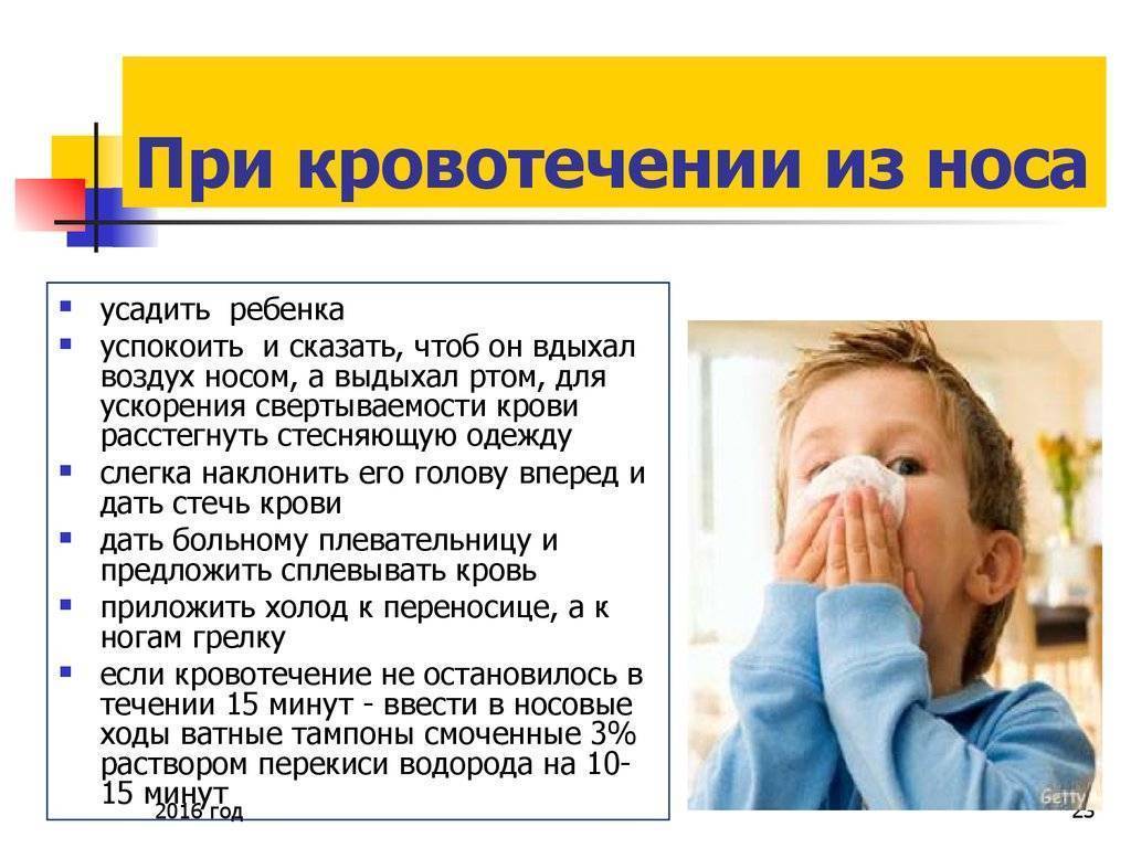 Как аккуратно остановить кровь из носа у ребенка