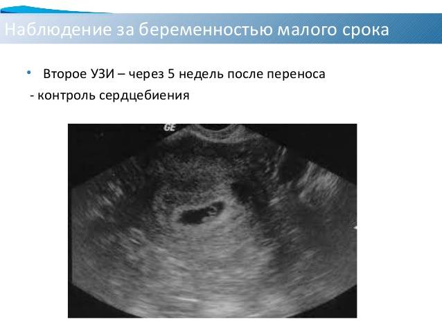 Что показывает узи по неделям беременности * клиника диана в санкт-петербурге