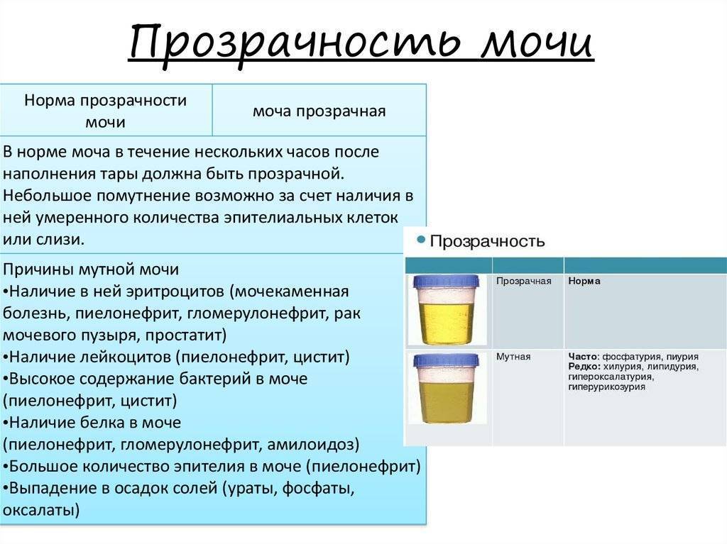 Моча красного цвета как признак болезни