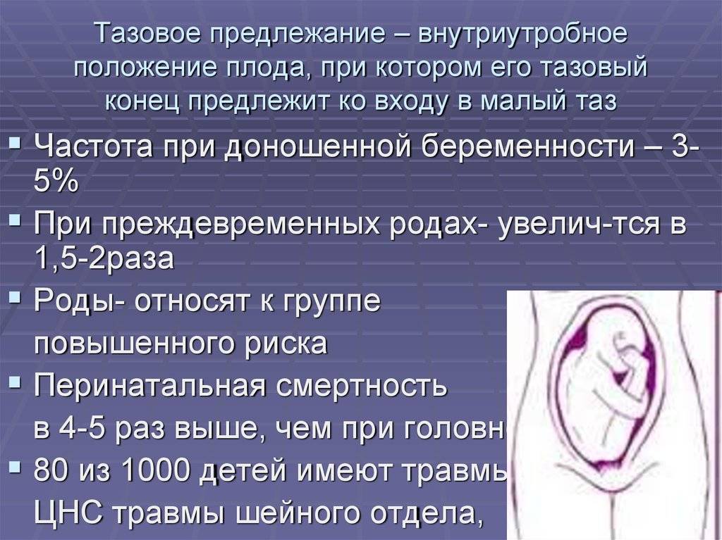 Тазовое предлежание – как повернуть малыша