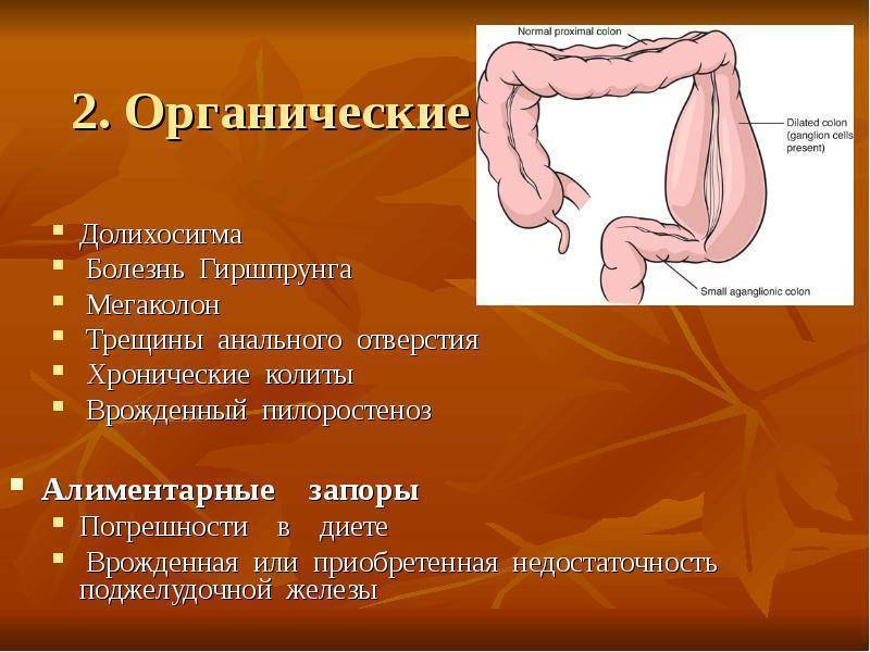 Лечить дискинезию кишечника в москве | медицинский центр «президент-мед»