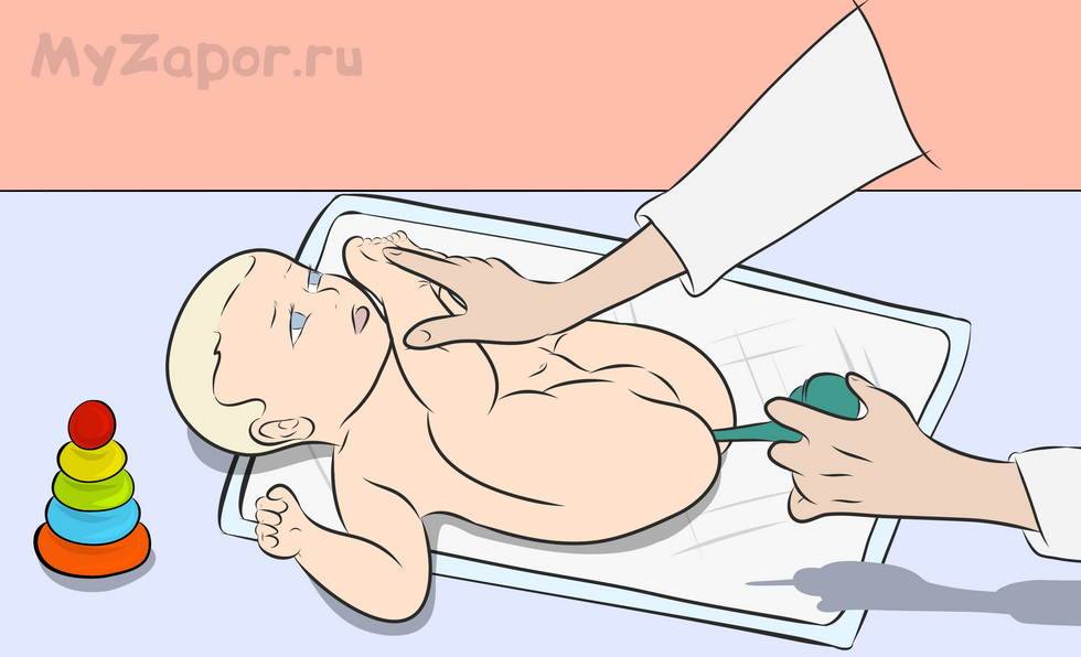 Как поставить клизму новорожденному ребенку правильно