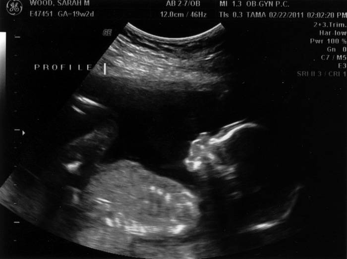 19 неделя беременности :: polismed.com