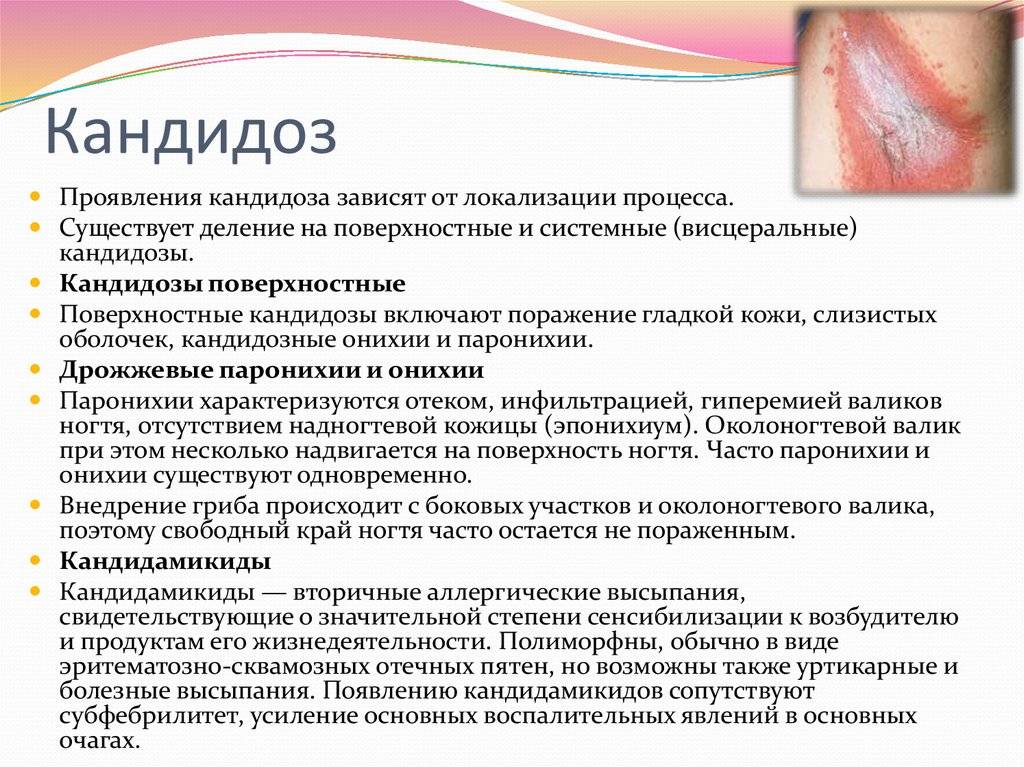 Воспаление половых губ ‒ вульвит