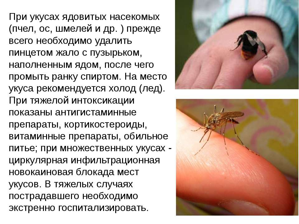 Первая помощь при укусах насекомых