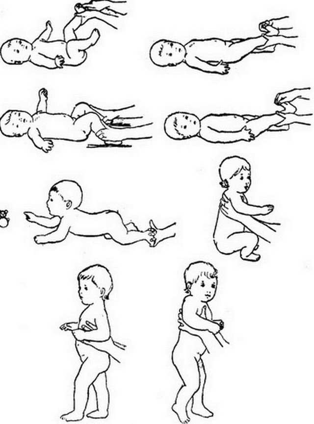 Массаж при кривошее у детей грудного возраста