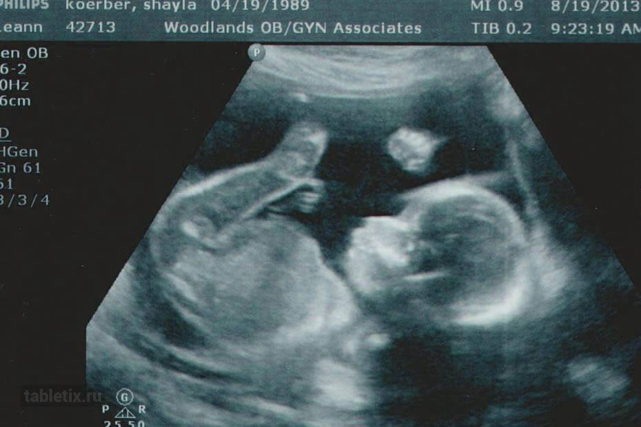 Что происходит с малышом на 21 неделе беременности (16 фото): развитие плода, как выглядит ребенок в 20-21 неделю, вес и размер, ощущения