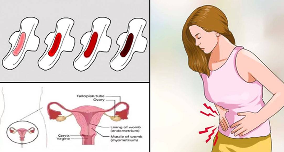 Сбой менструального цикла