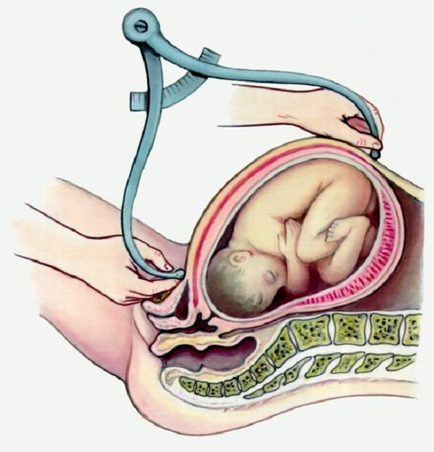 Замершая беременность: признаки, симптомы и причины. как определить замершую беременность. клиника ак. грищенко