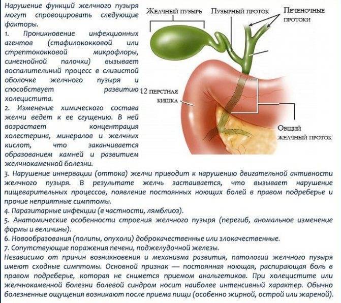 Холецистит
