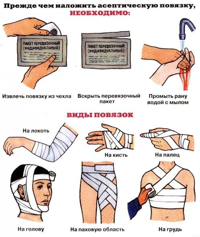 Кровь из носа у ребенка и взрослого: причины носового кровотечения и что делать – напоправку