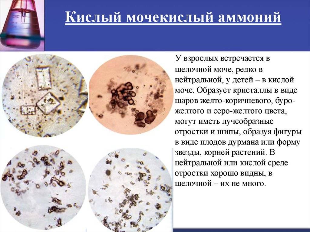 Диагностика и лечение заболеваний мочевыделительной системы у детей в москве