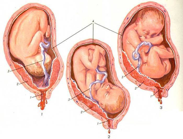 Шейка матки во время беременности: какие могут быть изменения?