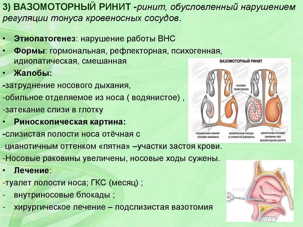 Истории болезни ринит