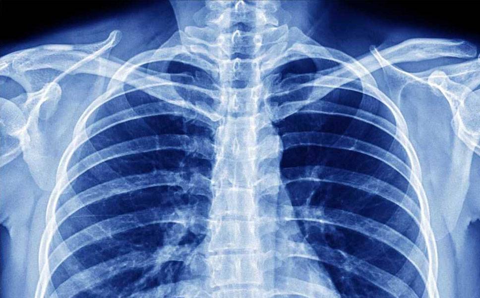 Рентген в новосибирске - цены в евромед клинике