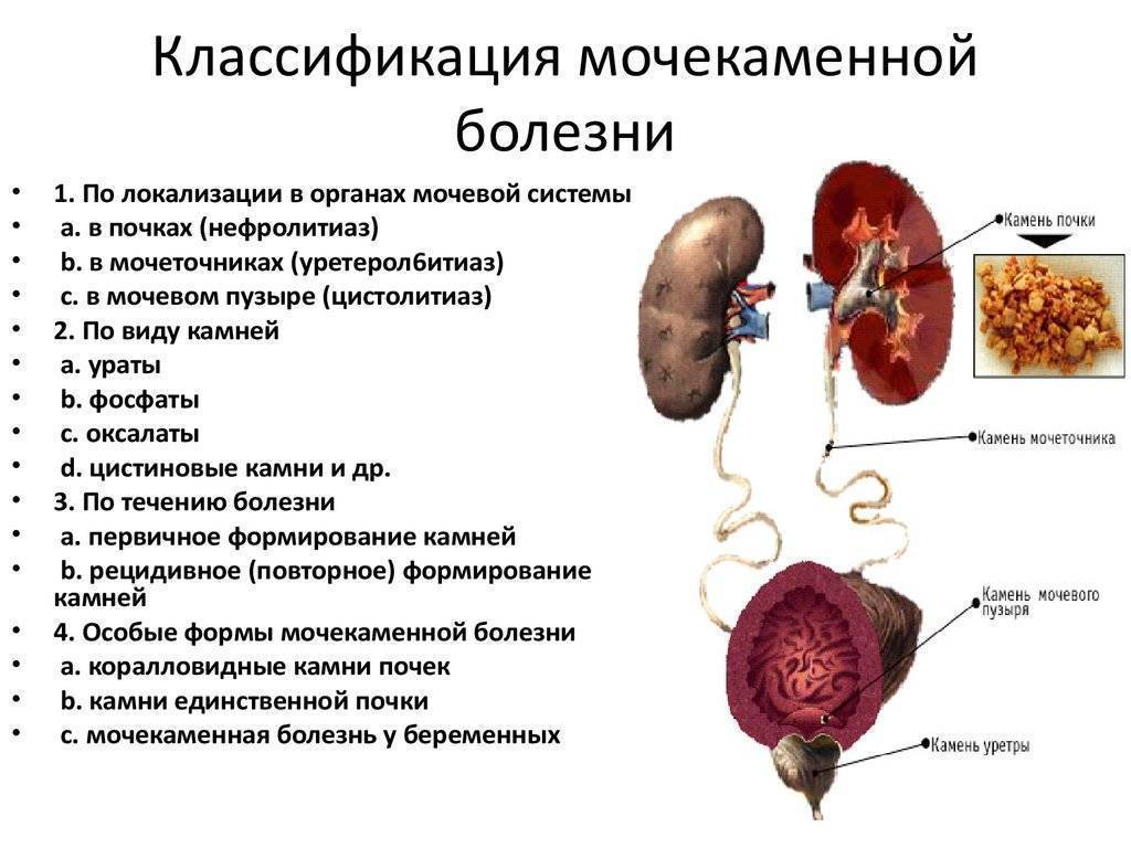 Персистирующая клоака
