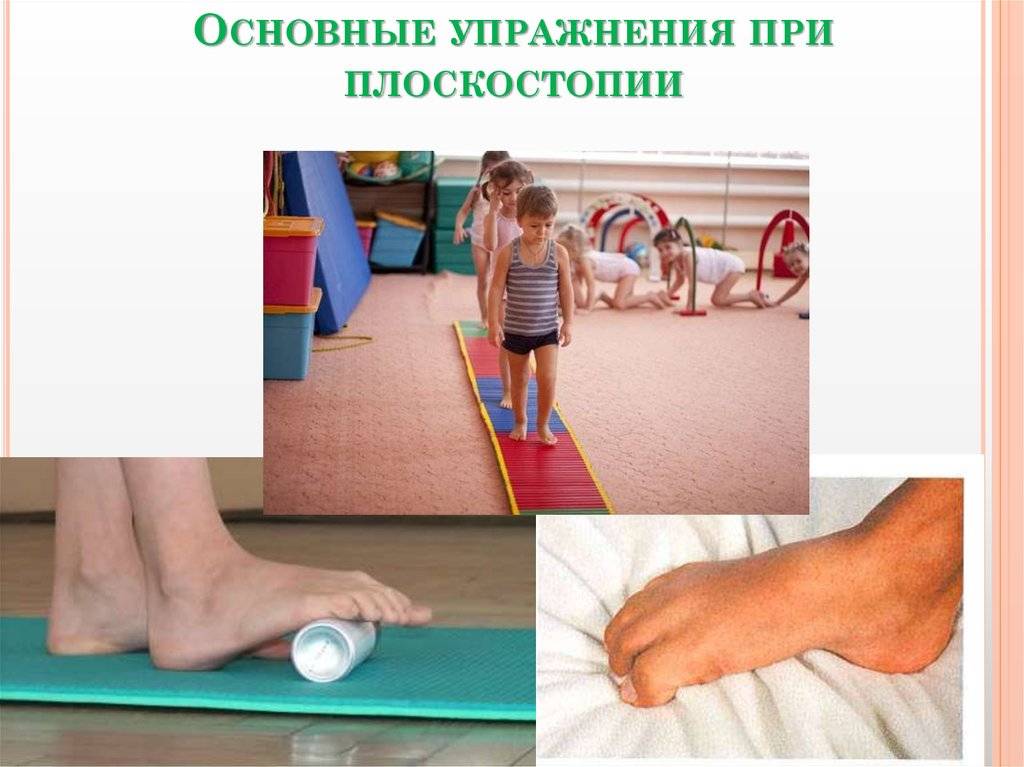 Профилактика плоскостопия у детей в доо — физинструктор.ру