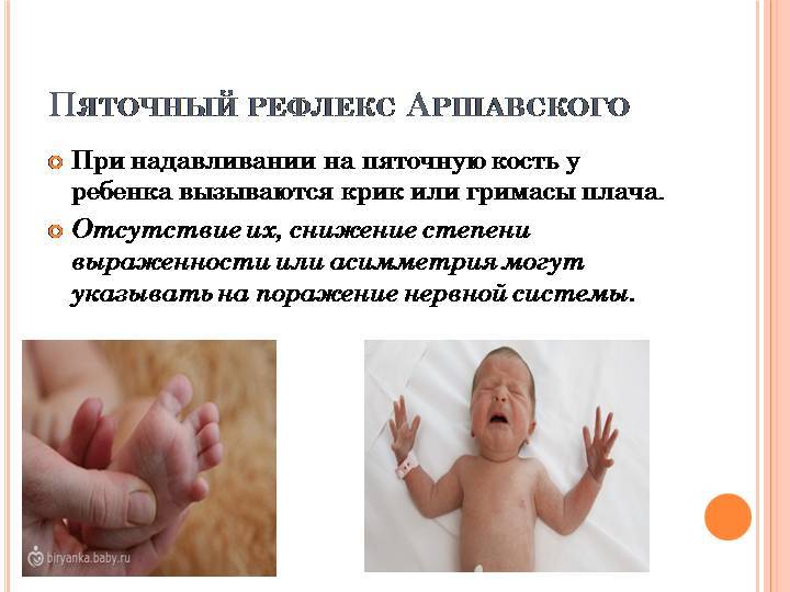 Рефлексы новорожденных и грудных детей: врожденные безусловные и условные / mama66.ru